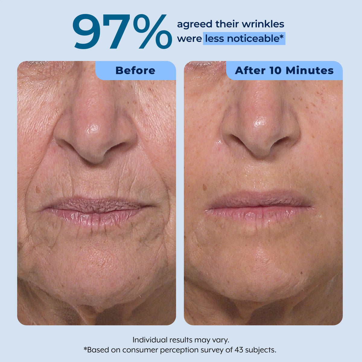Plexaderm Rapid Reduction Serum - Visibly Reduces Under-Eye Bags & Wrinkles