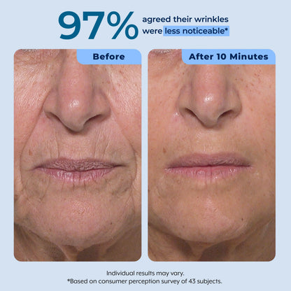 Plexaderm Rapid Reduction Serum - Visibly Reduces Under-Eye Bags & Wrinkles